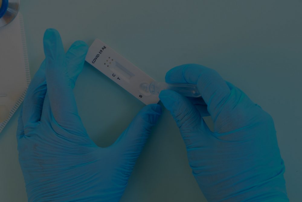 Fotografie a unor maini cu manusi chirurgicale ce manipuleaza un test rapid antigen de depistare al virusului SARS-CoV-2